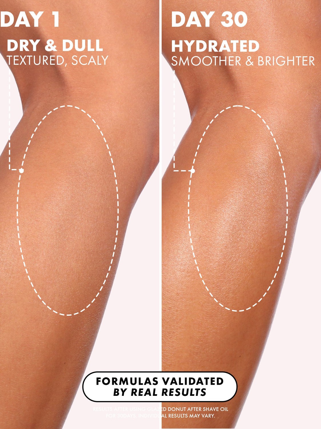 Piernas suaves, hidratadas y brillantes después de usar Truly